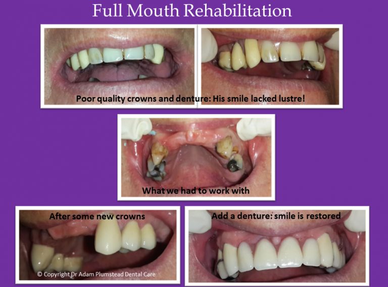 Gallery Plumstead Dental Care